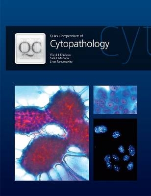 Quick Compendium of Cytopathology - Walid E. Khalbuss, Sara E. Monaco, Liron Pantanowitz