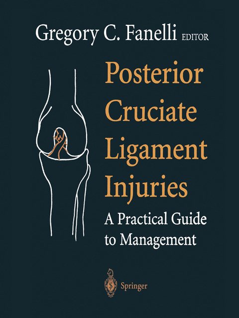 Posterior Cruciate Ligament Injuries - 