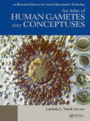An Atlas of Human Gametes and Conceptuses - 