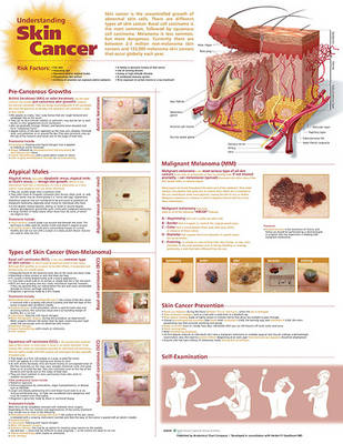 Understanding Skin Cancer Anatomical Chart