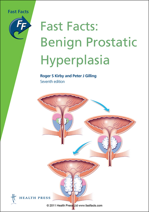 Fast Facts: Benign Prostatic Hyperplasia - Roger Kirby, Peter Gilling