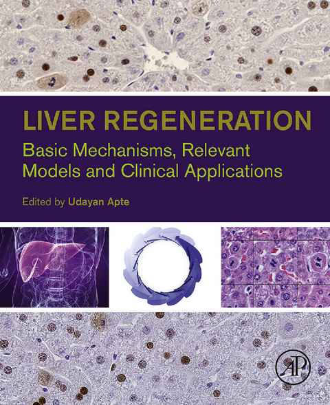 Liver Regeneration - 