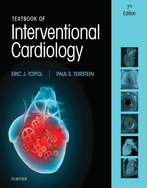 Textbook of Interventional Cardiology E-Book -  Paul S. Teirstein,  Eric J. Topol