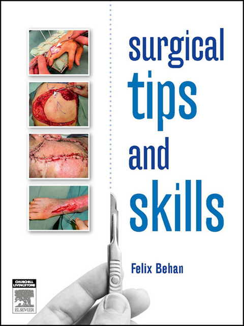 Surgical tips and skills - eBook -  Felix Behan