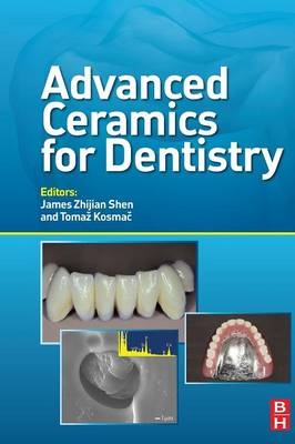 Advanced Ceramics for Dentistry - 