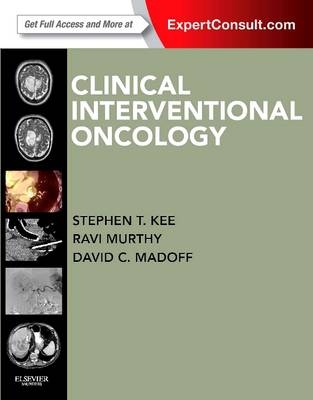 Clinical Interventional Oncology - Stephen Kee, David Madoff, Ravi Murthy