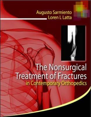 The Nonsurgical Treatment of Fractures in Contemporary Orthopedics - Augusto Sarmiento, Loren Latta