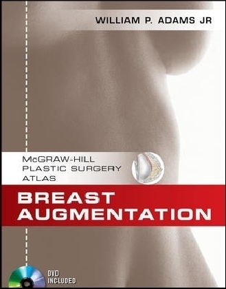 Breast Augmentation - William P. Adams