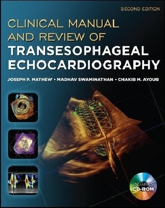 Clinical Manual and Review of Transesophageal Echocardiography, Second Edition - Joseph Mathew, Madhav Swaminathan, Chakib Ayoub