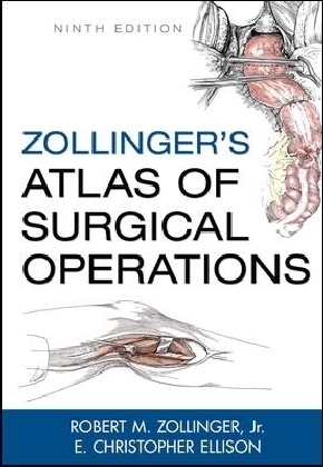 Zollinger's Atlas of Surgical Operations, Ninth Edition - Robert Zollinger, E. Ellison