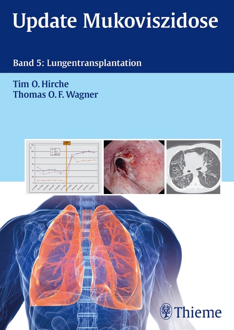 Update Mukoviszidose, Band 5 - Thomas O. F. Wagner, Tim O. Hirche