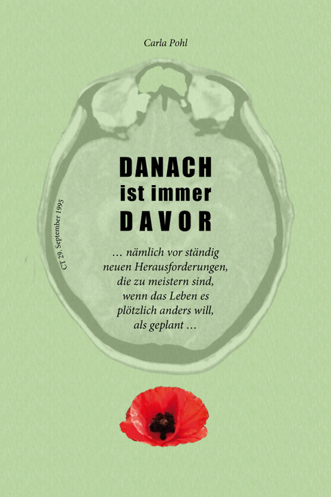 Danach ist immer Davor - Carla Pohl