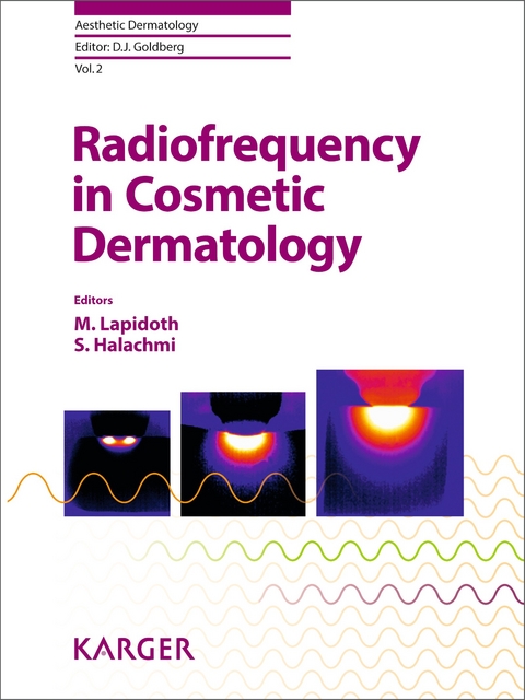 Radiofrequency in Cosmetic Dermatology - 