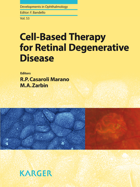 Cell-Based Therapy for Retinal Degenerative Disease - 