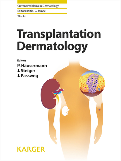 Transplantation Dermatology - 