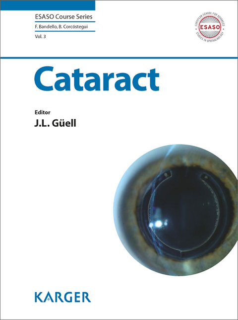 Cataract - 