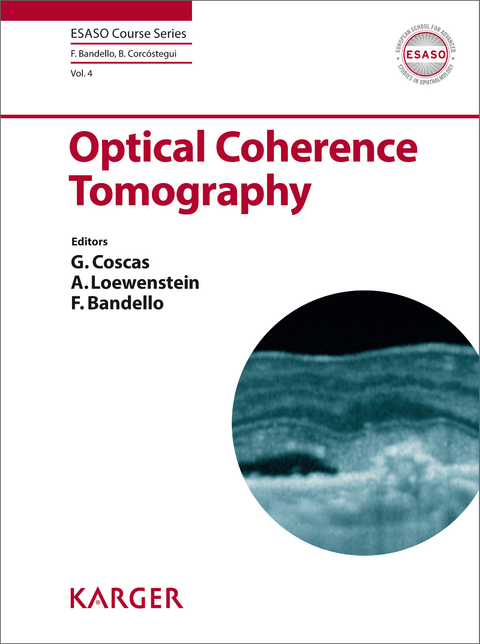 Optical Coherence Tomography - 