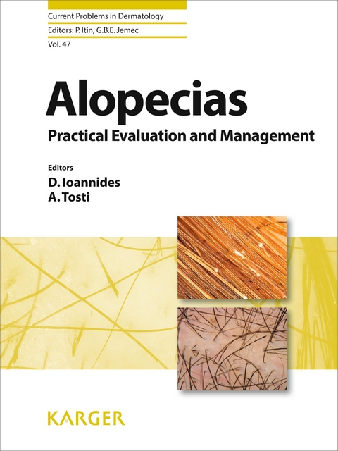 Alopecias - Practical Evaluation and Management - 