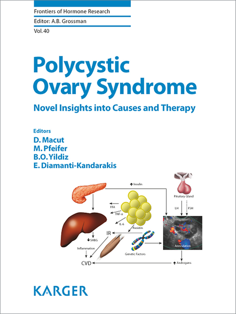 Polycystic Ovary Syndrome - 