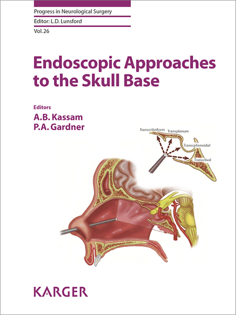 Endoscopic Approaches to the Skull Base - 