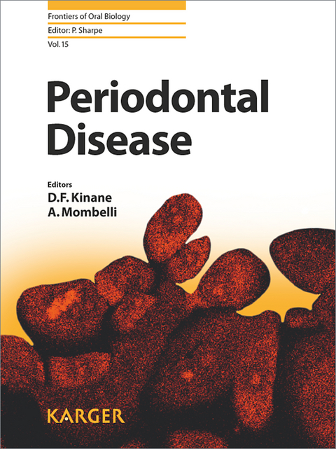 Periodontal Disease - 