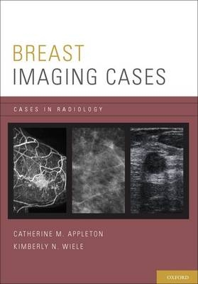 Breast Imaging Cases -  Catherine M. Appleton,  Kimberly N. Wiele