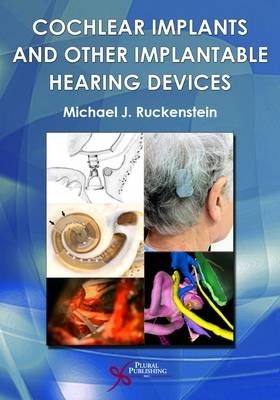 Cochlear Implants and Other Implantable Hearing Devices - 