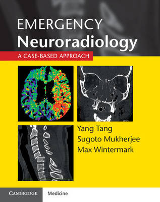 Emergency Neuroradiology - 