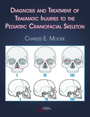 Diagnosis and Treatment of Traumatic Injuries to the Pediatric Craniofacial Skeleton - Charles E. Moore