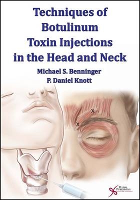 Techniques of Botulinum Toxin Injections in the Head and Neck - 
