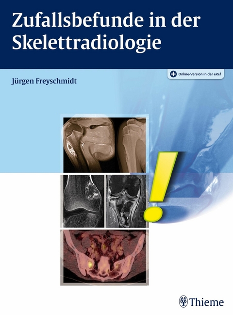 Zufallsbefunde in der Skelettradiologie - Jürgen Freyschmidt