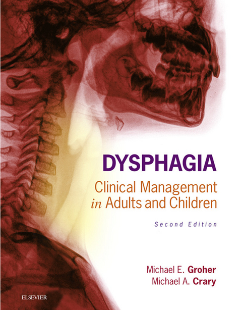 Dysphagia - E-Book -  Michael E. Groher,  Michael A. Crary
