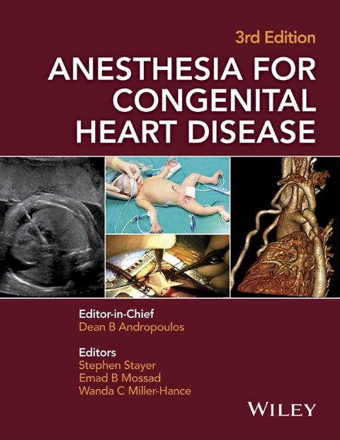 Anesthesia for Congenital Heart Disease - 