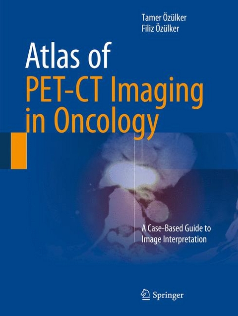 Atlas of PET-CT Imaging in Oncology - Tamer Özülker, Filiz Özülker