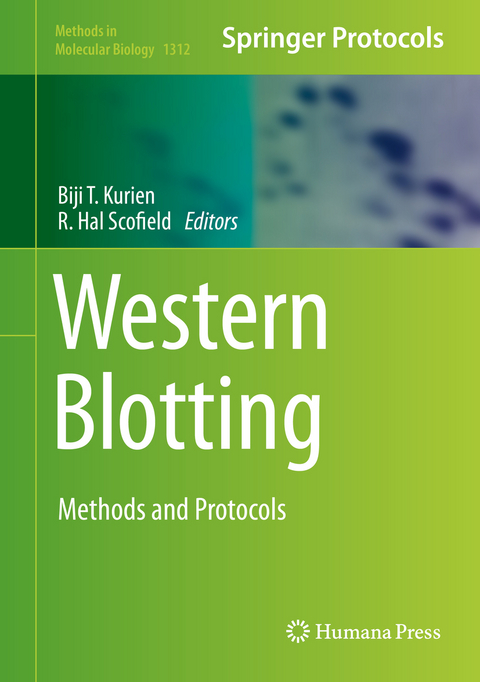 Western Blotting - 