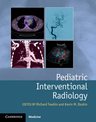 Pediatric Interventional Radiology - 