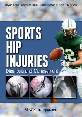 Sports Hip Injuries - 