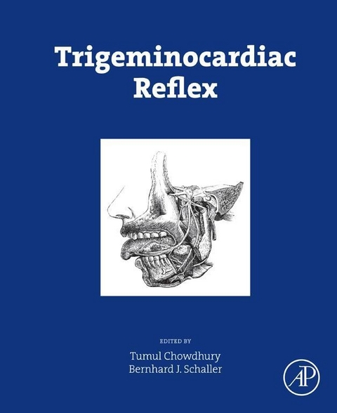 Trigeminocardiac Reflex - 