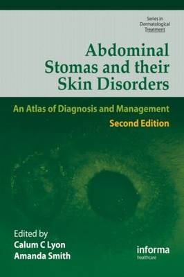 Abdominal Stomas and Their Skin Disorders - 