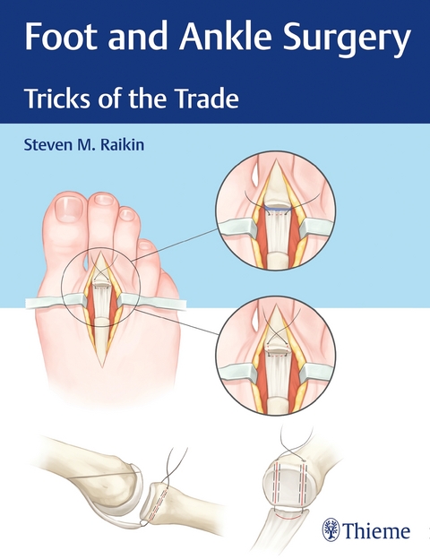Foot and Ankle Surgery - Steven Raikin