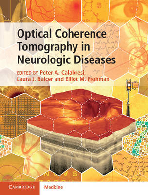 Optical Coherence Tomography in Neurologic Diseases - 