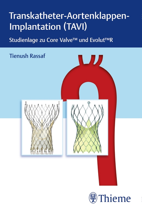 Transkatheter Aortenklappenimplantation (TAVI)