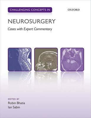 Challenging Concepts in Neurosurgery - 