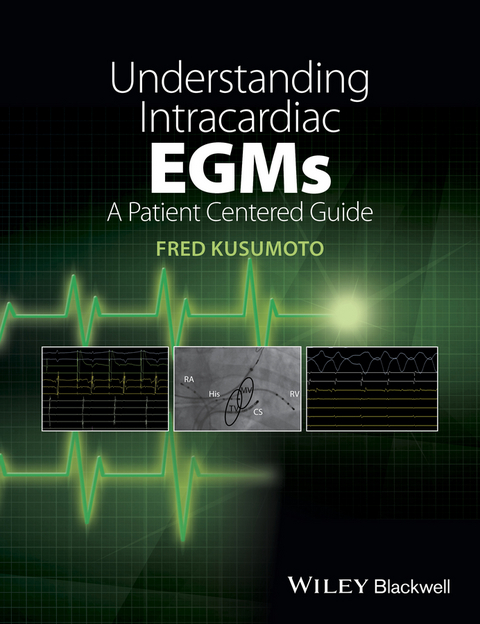 Understanding Intracardiac EGMs -  Fred M. Kusumoto