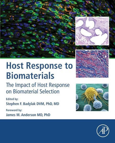 Host Response to Biomaterials - 