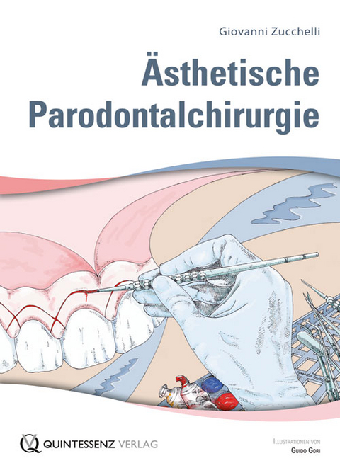 Ästhetische Parodontalchirurgie - Giovanni Zucchelli