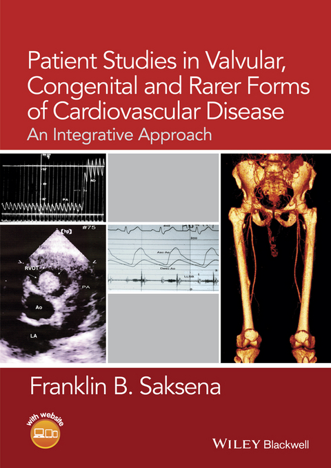 Patient Studies in Valvular, Congenital, and Rarer Forms of Cardiovascular Disease -  Franklin B. Saksena