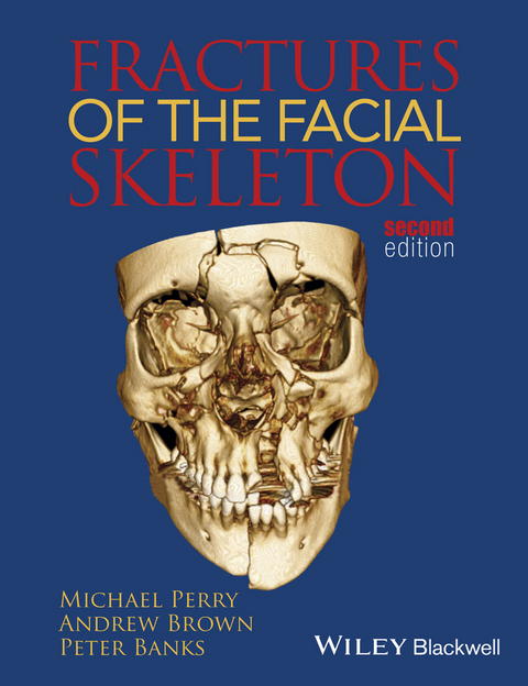 Fractures of the Facial Skeleton -  Peter Banks,  Andrew Brown,  Michael Perry