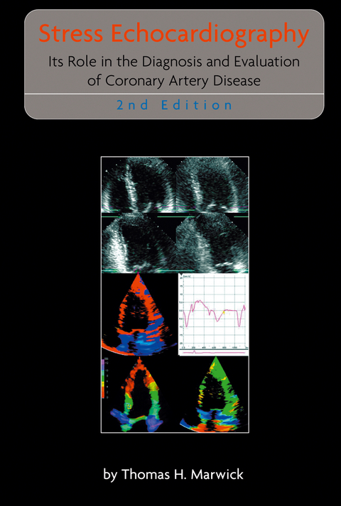 Stress Echocardiography - Thomas H. Marwick