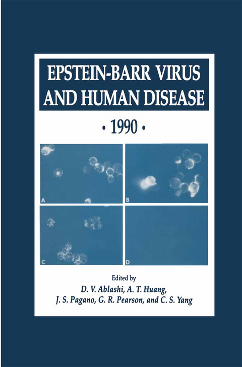 Epstein-Barr Virus and Human Disease · 1990 - 